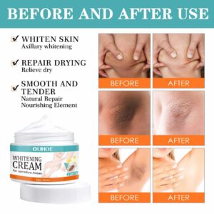 Fast Action Whitening Cream for Private Parts